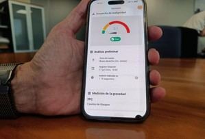 Aragón lanza prueba de IA para optimizar atención dermatológica en salud pública