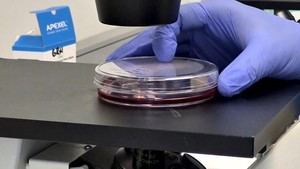 Hospital 12 de Octubre valida una vacuna oral contra el virus del Ébola