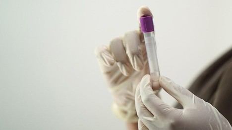 El Hospital Príncipe de Asturias logra certificación de calidad en Hematología