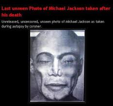  Salen a la luz algunos secretos que revelaba tras su autopsia el cuerpo de Michael Jackson