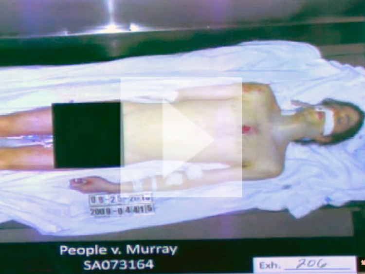  Salen a la luz algunos secretos que revelaba tras su autopsia el cuerpo de Michael Jackson