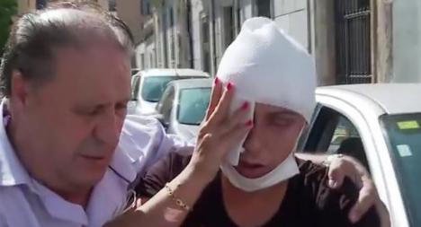La mujer atacada con sosa cáustica, asegura haber perdido el ojo